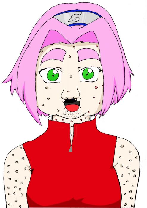 Ugly Fat Pimply Warty Sakura Haruno